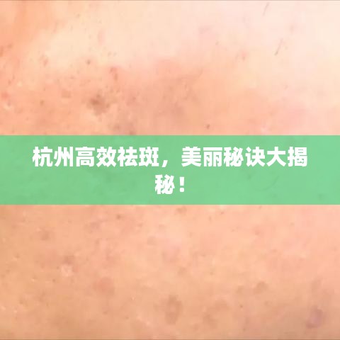 杭州高效祛斑，美麗秘訣大揭秘！